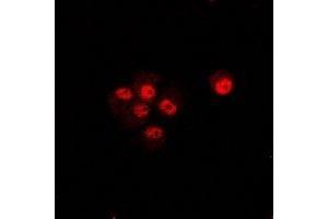 Immunofluorescent analysis of CIP4 staining in U2OS cells. (TRIP10 抗体)