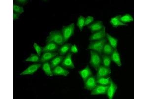 Immunofluorescence analysis of HeLa cells using SSRP1 Polyclonal Antibody (SSRP1 抗体)