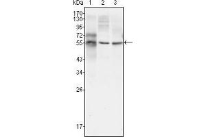 Western blot analysis using TUBB3 mouse mAb against HepG2 (1), A549 (2) and Hela (3) cell lysate. (TUBB3 抗体)