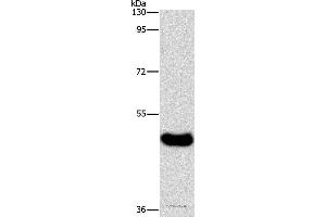 Western blot analysis of Human normal liver tissue, using BAAT Polyclonal Antibody at dilution of 1:600 (BAAT 抗体)