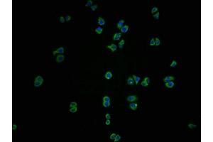 Immunofluorescence staining of PC3 cells with ABIN7156538 at 1:100, counter-stained with DAPI. (ICAM-3/CD50 抗体  (AA 200-547))