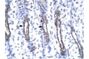 MMP19 antibody was used for immunohistochemistry at a concentration of 4-8 ug/ml to stain Epithelial cells (arrows) in Human Urinary bladder. (MMP19 抗体  (N-Term))