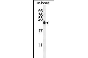 S3 Antibody (N-term) 0390a western blot analysis in mouse heart tissue lysates (35 μg/lane). (AP1S3 抗体  (N-Term))