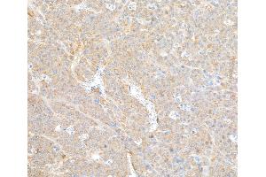 Immunohistochemistry (IHC) image for anti-Coatomer Protein Complex, Subunit beta 2 (COPB2) (AA 856-906) antibody (ABIN7453569) (COPB2 抗体  (AA 856-906))