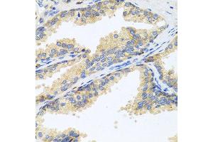 Immunohistochemistry of paraffin-embedded human prostate using WFDC2 antibody at dilution of 1:100 (40x lens).