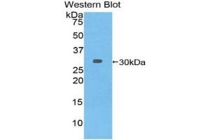 Detection of Recombinant TUBb6, Mouse using Polyclonal Antibody to Tubulin Beta 6 (TUBb6) (TUBb6 抗体  (AA 194-421))