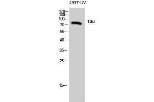 Western Blotting (WB) image for anti-tau Protein (Ser824) antibody (ABIN3187172) (tau 抗体  (Ser824))