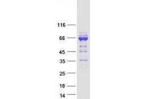 Validation with Western Blot