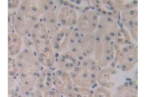 Immunohistochemistry (IHC) image for anti-Glycoprotein IX (Platelet) (GP9) (AA 1-189) antibody (ABIN7442297)