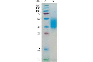 Human IL4RA Protein, His Tag on SDS-PAGE under reducing condition.
