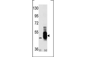 Western blot analysis of MEKK8 using MEKK8 Antibody using 293 cell lysates (2 ug/lane) either nontransfected (Lane 1) or transiently transfected with the MAP3K8 gene (Lane 2). (CROT 抗体  (C-Term))