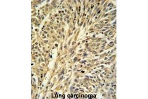 Immunohistochemistry (IHC) image for anti-IMP (Inosine 5'-Monophosphate) Dehydrogenase 2 (IMPDH2) antibody (ABIN3003184) (IMPDH2 抗体)