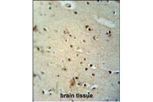 Immunohistochemistry (Paraffin-embedded Sections) (IHC (p)) image for anti-Capicua Homolog (CIC) (AA 174-203), (N-Term) antibody (ABIN654662)