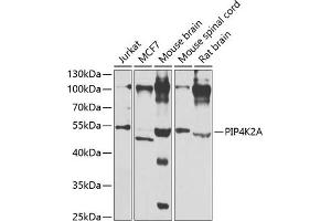 PIP4K2A 抗体  (AA 120-350)