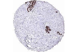 Immunohistochemistry (IHC) image for anti-Tumor Protein P53 (TP53) antibody (ABIN7477547)