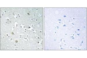 Immunohistochemistry analysis of paraffin-embedded human brain, using PLA1A Antibody. (PLA1A 抗体  (AA 381-430))