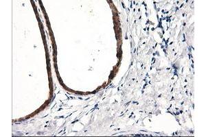 Immunohistochemical staining of paraffin-embedded Human breast tissue using anti-RGS16 mouse monoclonal antibody. (RGS16 抗体)