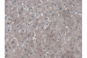 Detection of SYMPK in Human Liver Tissue using Polyclonal Antibody to Symplekin (SYMPK) (Symplekin 抗体  (AA 1-347))