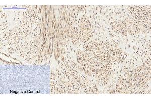 Immunohistochemical analysis of paraffin-embedded human uterus tissue. (PI3K p85 alpha/gamma 抗体)