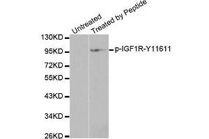 Western blot analysis of extracts from 293 cells, using Phospho-IGF1R-Y1161 antibody (ABIN2988064). (IGF1R 抗体  (pTyr1161))