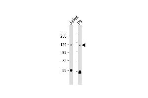 All lanes : Anti-SIRT1 Antibody at 1:1000 dilution Lane 1: Jurkat whole cell lysate Lane 2: F9 whole cell lysate Lysates/proteins at 20 μg per lane. (SIRT1 抗体  (AA 1-180))