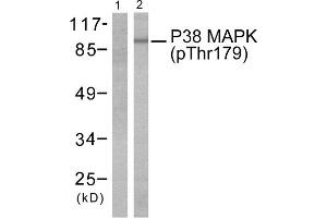 Western blot analysis of extracts from Hela cells treated with TNF- alpha (20ng/ml, 5mins), using P38 MAPK (phospho-Thr180) antibody (Line 1 and 2). (MAPK14 抗体  (pThr180))