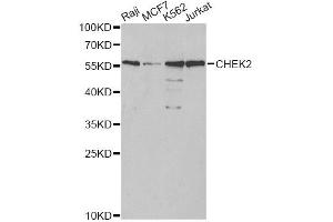 Western blot analysis of extracts of various cell lines, using CHEK2 antibody. (CHEK2 抗体)