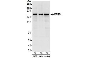 anti-Glutamyl-Prolyl-tRNA Synthetase (EPRS) (AA 150-200) antibody