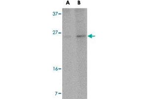 Western blot analysis of RCAN2 in NIH/3T3 cell lysate with RCAN2 polyclonal antibody  at (A) 1 and (B) 2 ug/mL . (RCAN2 抗体  (Internal Region))