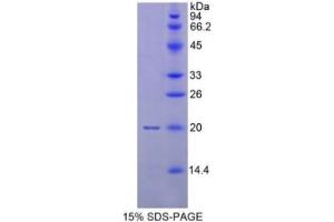 SDS-PAGE of Protein Standard from the Kit  (Highly purified E. (MMP 9 ELISA 试剂盒)