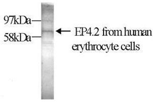 Western Blot (10% gel) with the anti-transglutaminase antibody EP4. (EPB42 抗体)