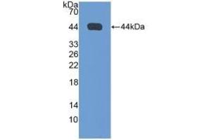 Detection of Recombinant NPPA, Rat using Polyclonal Antibody to Natriuretic Peptide Precursor A (NPPA)