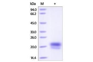 Human VEGF-C, His Tag on SDS-PAGE under reducing (R) condition. (VEGFC Protein (AA 103-227) (His tag))