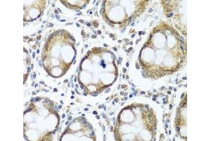 Immunohistochemistry of paraffin-embedded Human colon using IFI44 Polyclonal Antibody at dilution of 1:100 (40x lens). (IFI44 抗体)