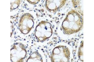 Immunohistochemistry of paraffin-embedded Human colon using IFI44 Polyclonal Antibody at dilution of 1:100 (40x lens).