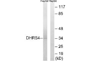 Immunohistochemistry analysis of paraffin-embedded human breast carcinoma tissue, using DHRS4 antibody.