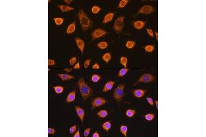 Immunofluorescence (IF) image for anti-Succinate Dehydrogenase Complex, Subunit B, Iron Sulfur (Ip) (SDHB) (AA 29-280) antibody (ABIN6147472)