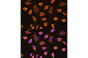 Immunofluorescence analysis of L929 cells using SDHB Rabbit pAb (ABIN6131588, ABIN6147472, ABIN6147474 and ABIN6215002) at dilution of 1:100. (SDHB 抗体  (AA 29-280))
