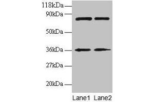 Western blot All lanes: HNRNPH1 antibody at 2 μg/mL Lane 1: EC109 whole cell lysate Lane 2: 293T whole cell lysate Secondary Goat polyclonal to rabbit IgG at 1/15000 dilution Predicted band size: 50 kDa Observed band size: 36 kDa (HNRNPH1 抗体  (AA 2-216))