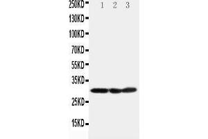 Anti-COMT antibody, Western blotting Lane 1: HELA Cell Lysate Lane 2: A375 Cell Lysate Lane 3: PANC Cell Lysate (COMT 抗体  (N-Term))