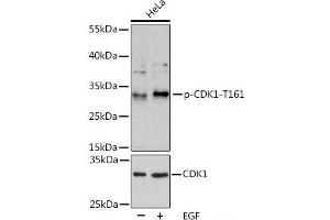 Western blot analysis of extracts of HeLa cells using Phospho-CDK1(T161) Polyclonal Antibody at dilution of 1:1000. (CDK1 抗体  (pThr161))