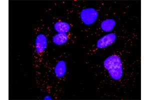 Proximity Ligation Assay (PLA) image for anti-Protein Phosphatase, Mg2+/Mn2+ Dependent, 1B (PPM1B) (AA 1-479) antibody (ABIN519087)