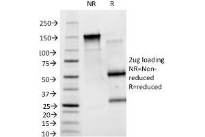 SDS-PAGE Analysis Purified Blood Group B Monoclonal Antibody (HEB-20). (ABO 抗体)