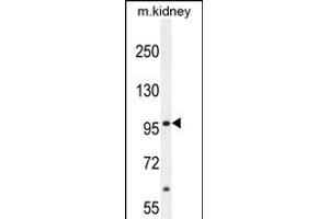 MED25 Antibody (N-term) (ABIN654162 and ABIN2844026) western blot analysis in mouse kidney tissue lysates (35 μg/lane). (MED25 抗体  (AA 112-140))