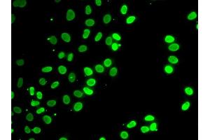 Immunofluorescence analysis of HeLa cells using SEPT7 antibody (ABIN6291642). (Septin 7 抗体)