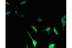 Immunofluorescent analysis of U251 cells using ABIN7171850 at dilution of 1:100 and Alexa Fluor 488-congugated AffiniPure Goat Anti-Rabbit IgG(H+L) (Tetraspanin 14 抗体  (AA 114-215))