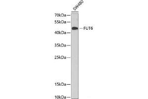 Western blot analysis of extracts of SW480 cells using FUT6 Polyclonal Antibody at dilution of 1:1000. (FUT6 抗体)