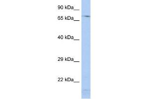 WB Suggested Anti-SRP72 Antibody Titration:  0. (SRP72 抗体  (Middle Region))