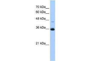 WB Suggested Anti-GGPS1 Antibody Titration:  0. (GGPS1 抗体  (C-Term))