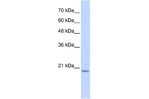 PFDN6 antibody used at 1 ug/ml to detect target protein. (PFDN6 抗体  (N-Term))